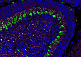 Cerebellar development and disease at single-cell resolution